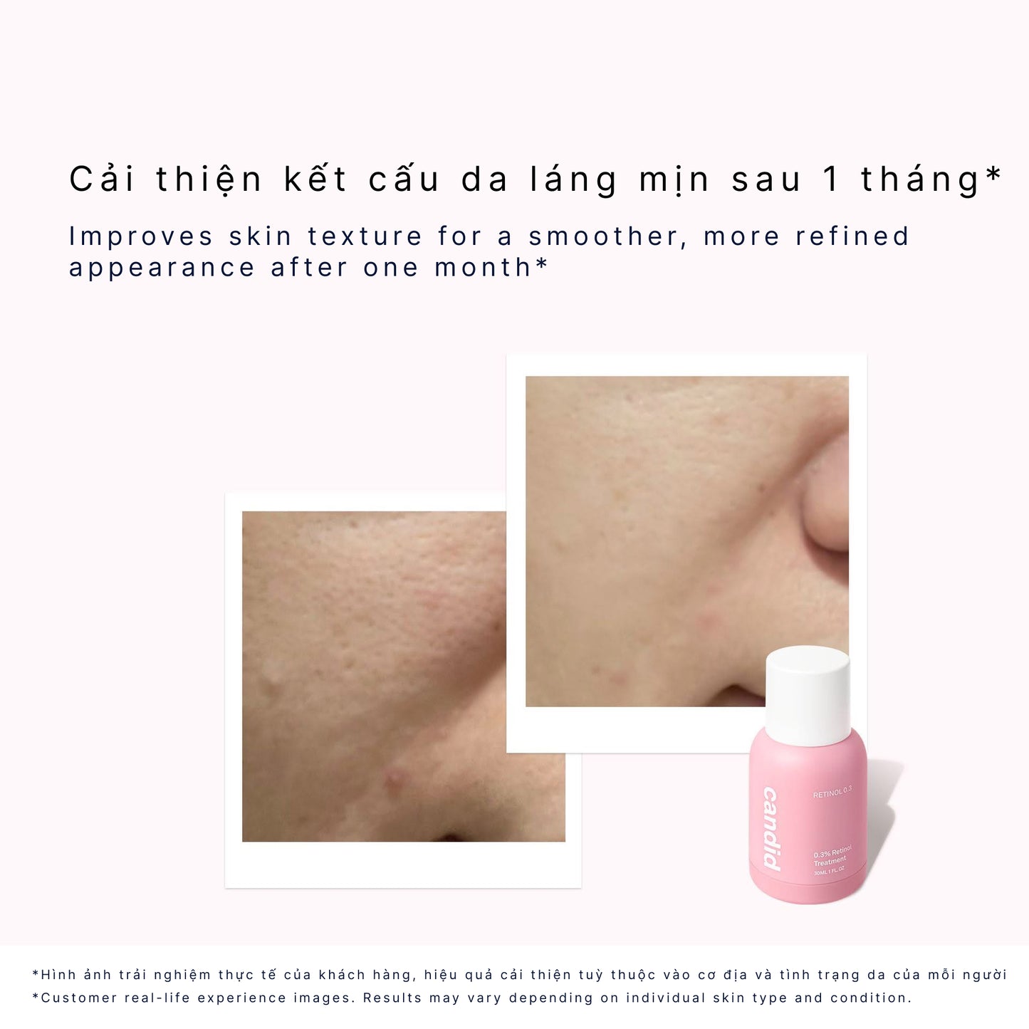 Retinol 0.3 Serum